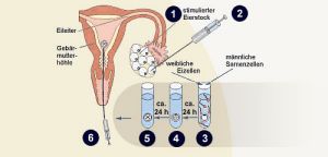 In vitro Fertilisation (IVF) Bayreuth